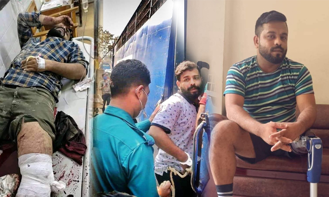 পা হারানো সেই সাইফই এখন চট্টগ্রামের রাজনীতিতে আলোচিত মুখ &nbsp;&nbsp;